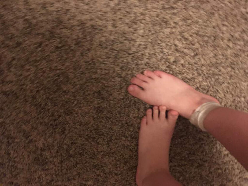 Ankles and Awkardness